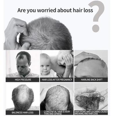 Anti-Hair Loss Hair Tonic